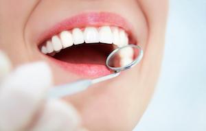 close up of woman getting dental exam with dental mirror in anderson
