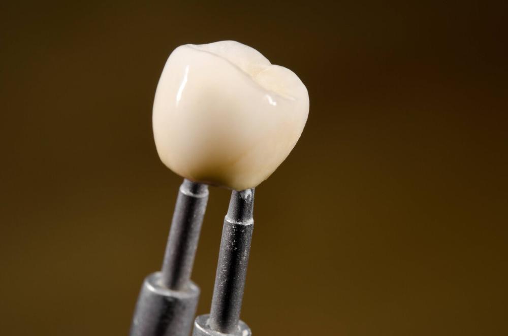 dental crown