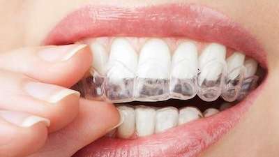 close up of person using invisalign from anderson dental office
