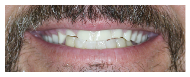 Hopewell Family Dentistry Before Smile