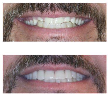 Hopewell Family Dentistry Smile Gallery